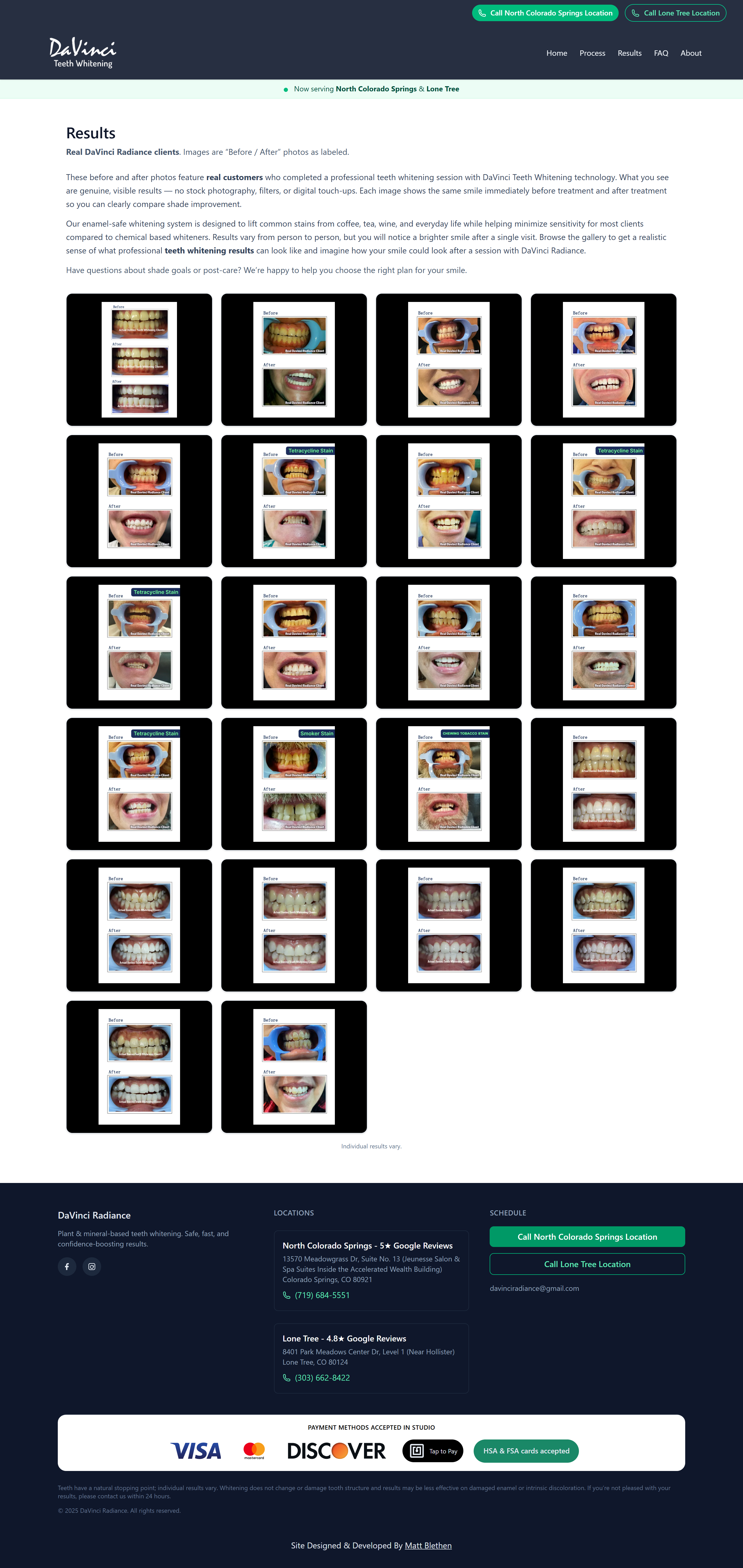 Results gallery showing real before/after client whitening outcomes